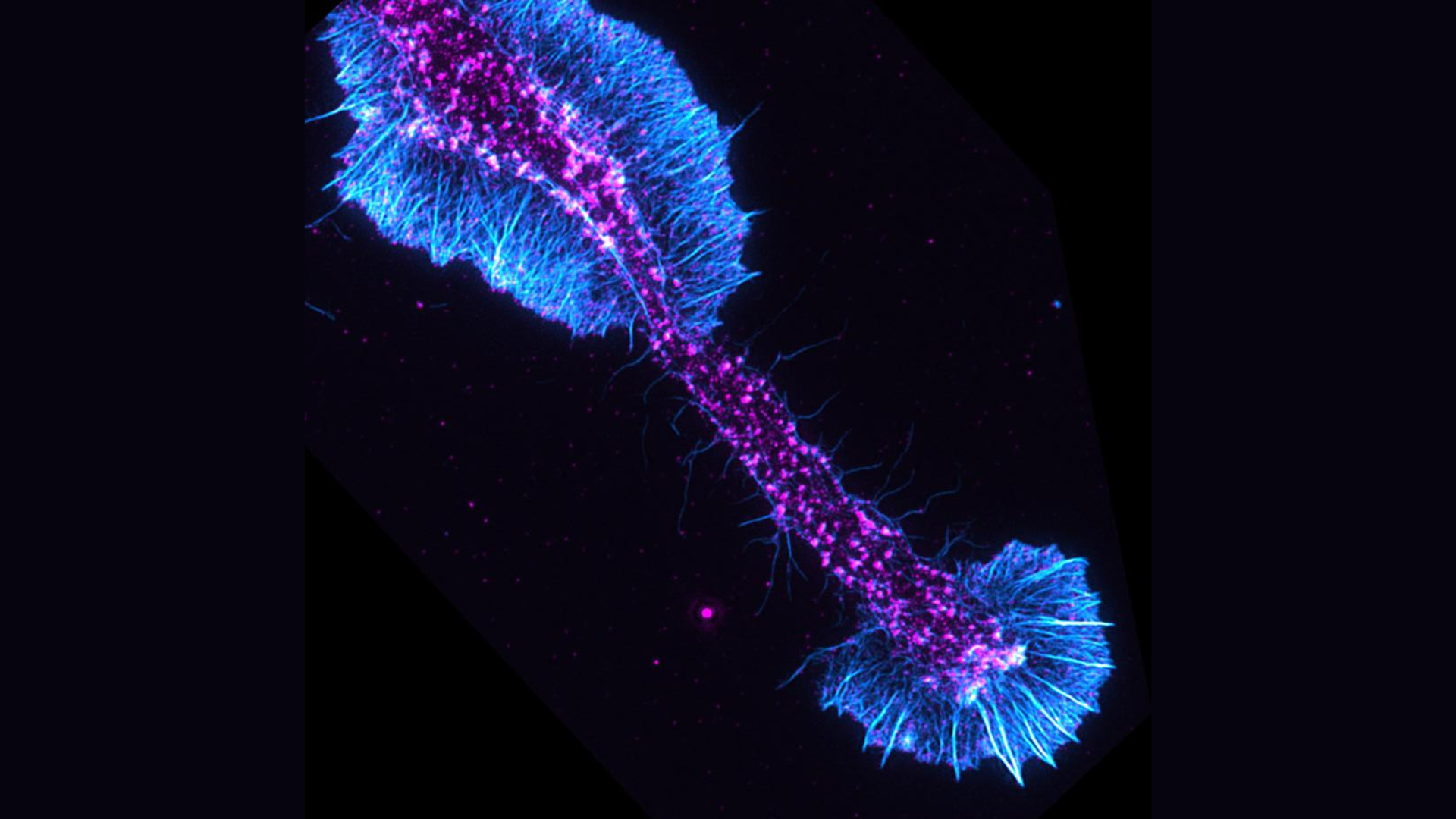 Image of actin filaments (cyan) and an actin regulatory protein (magenta) in a differentiating oligodendrocyte. Credit: Andrew Olson and Brad Zuchero, Neuroscience imaging core (before it was called Wu Tsai Nero’s Neuroscience Microscopy Service). 