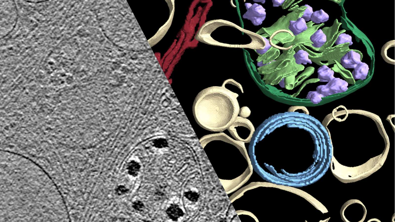 Cryogenic electron tomography (cryoET) image (left) and AI-based segmentation (right) of subcellular features in a human fibroblast, used to investigate the molecular architecture underlying neurodegenerative diseases.