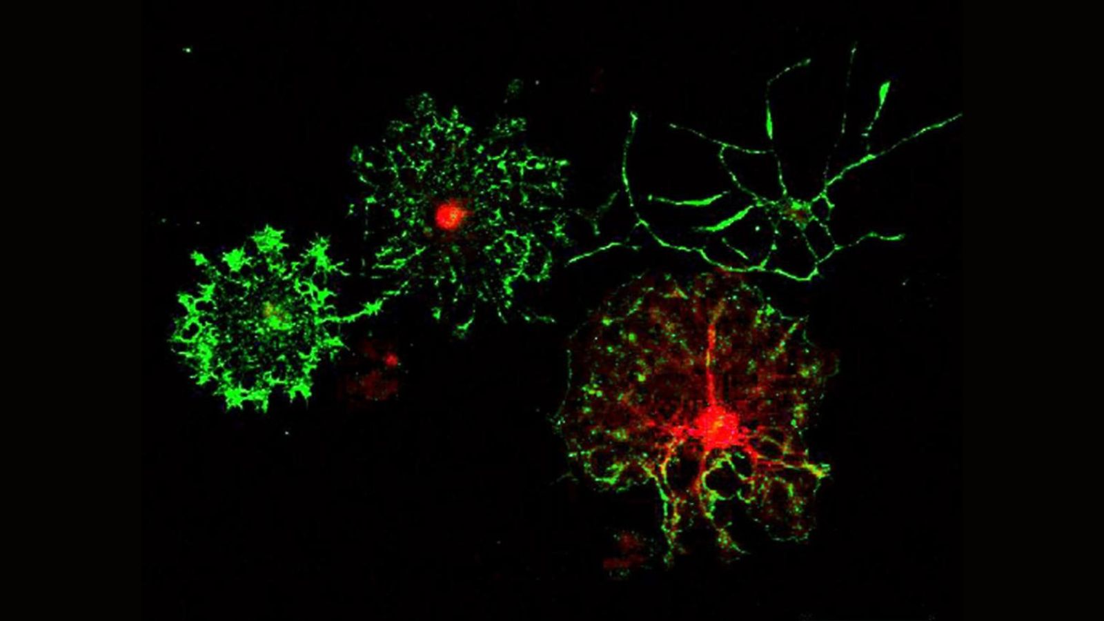 Oligodendrocyte precursor cells (OPCs) that the Gibson lab cultures in vitro and differentiates into myelinating oligodendrocytes.