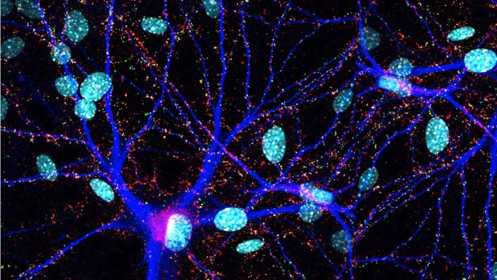 A culture of human neurons with mouse glia stained for synapsin (red) and PSD95 (green), labeled with DAPI (light blue), and containing a transfected neuron expressing blue fluorescence protein (dark blue)