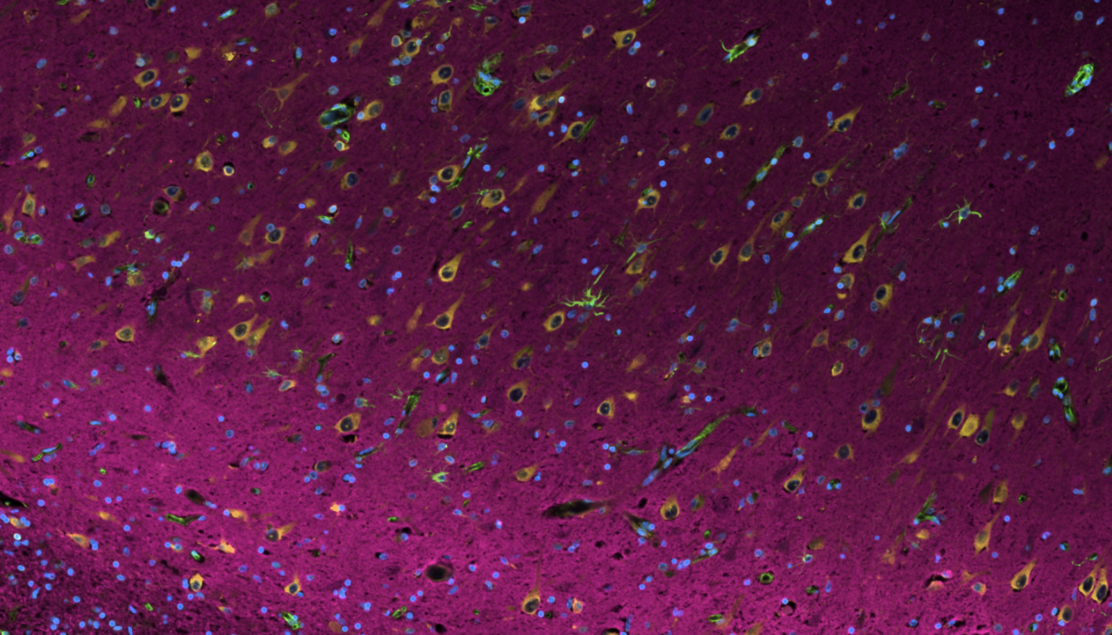 hippocampal cells 