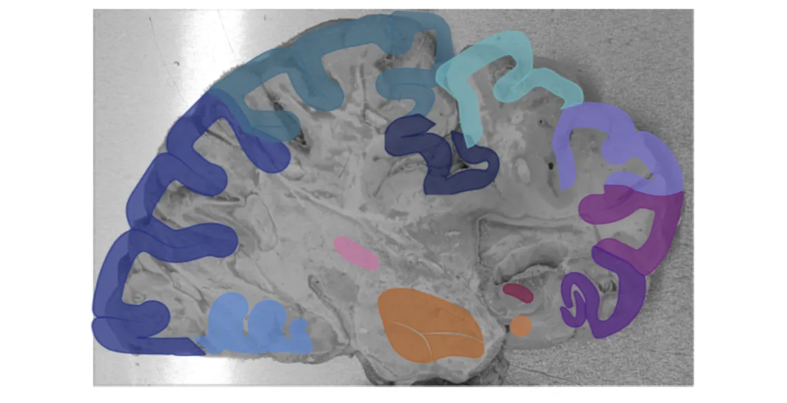 Brain Region dissection. Credit Brain Resilience Lab.