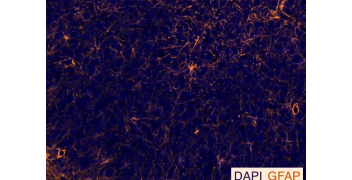 Cerebellar Astrocytes. Credit Lundberg Lab.