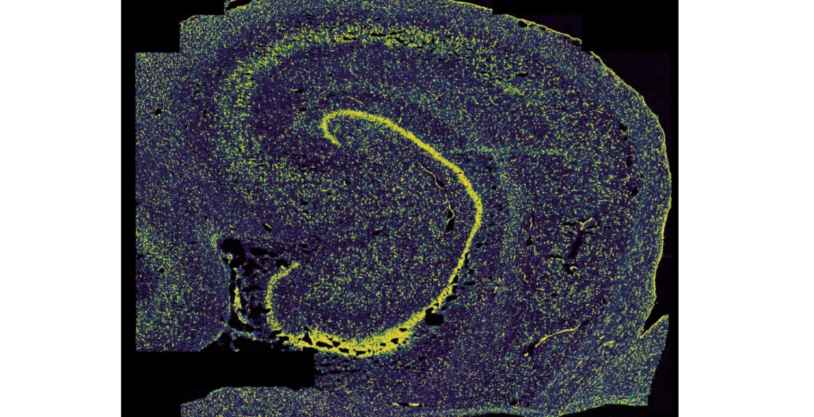 Xenium Transcriptomic image of human hippocampus. Credit Brain Resilience Lab.