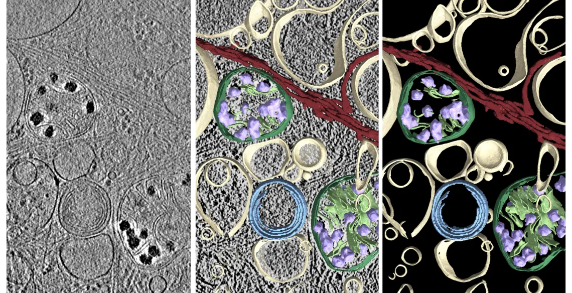 Cryogenic electron tomography (cryoET) image (left), overlay center, and AI-based segmentation (right) of subcellular features in a human fibroblast, used to investigate the molecular architecture underlying neurodegenerative diseases. 