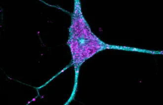 A neuron outlined in blue with purple dots indicating amyloid beta 42.