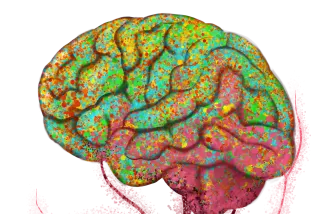 A illustration of the brain (in green and yellow) connected to blood vessels of the body (in red).