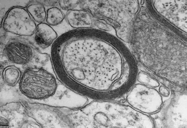 A dark ring of myelin in a black and white image of a cell.