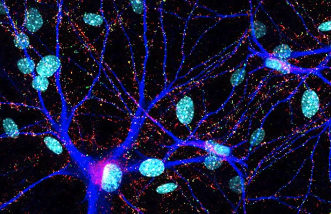 A culture of human neurons with mouse glia stained for synapsin (red) and PSD95 (green), labeled with DAPI (light blue), and containing a transfected neuron expressing blue fluorescence protein (dark blue)