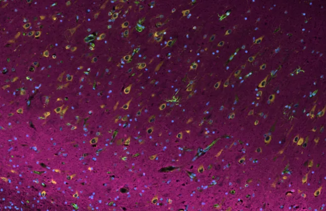 Eloise Berson hippocampal cells image