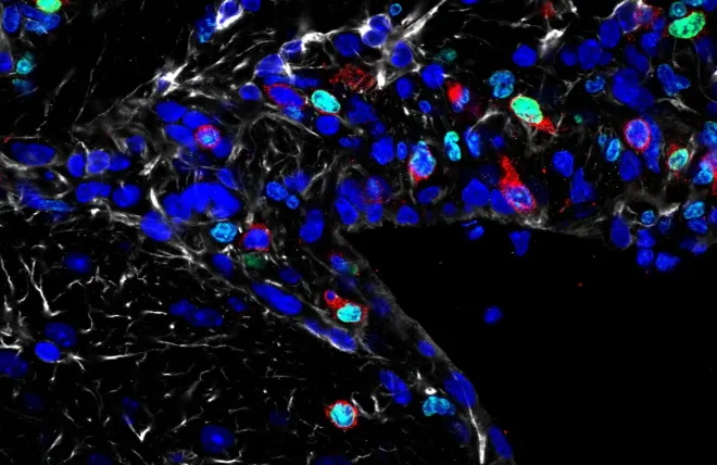 Blue, green, and red blobs on a black background.