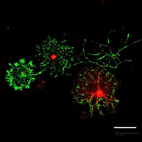 Oligodendrocyte precursor cells (OPCs) that the Gibson lab cultures in vitro and differentiates into myelinating oligodendrocytes. Image by Erin Gibson.