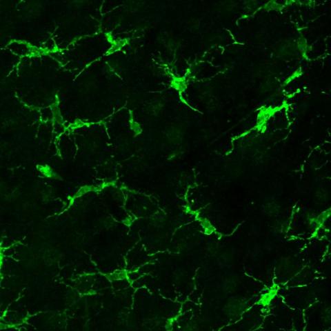 A microscope image of microglia in green.