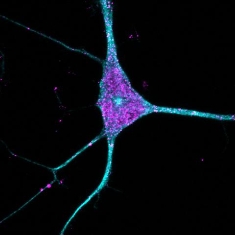 In pursuit of brain resilience | Knight Initiative