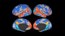 Brain scan images with some regions highlighted in reds and blues.