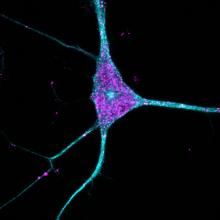 A neuron outlined in blue with purple dots indicating amyloid beta 42.