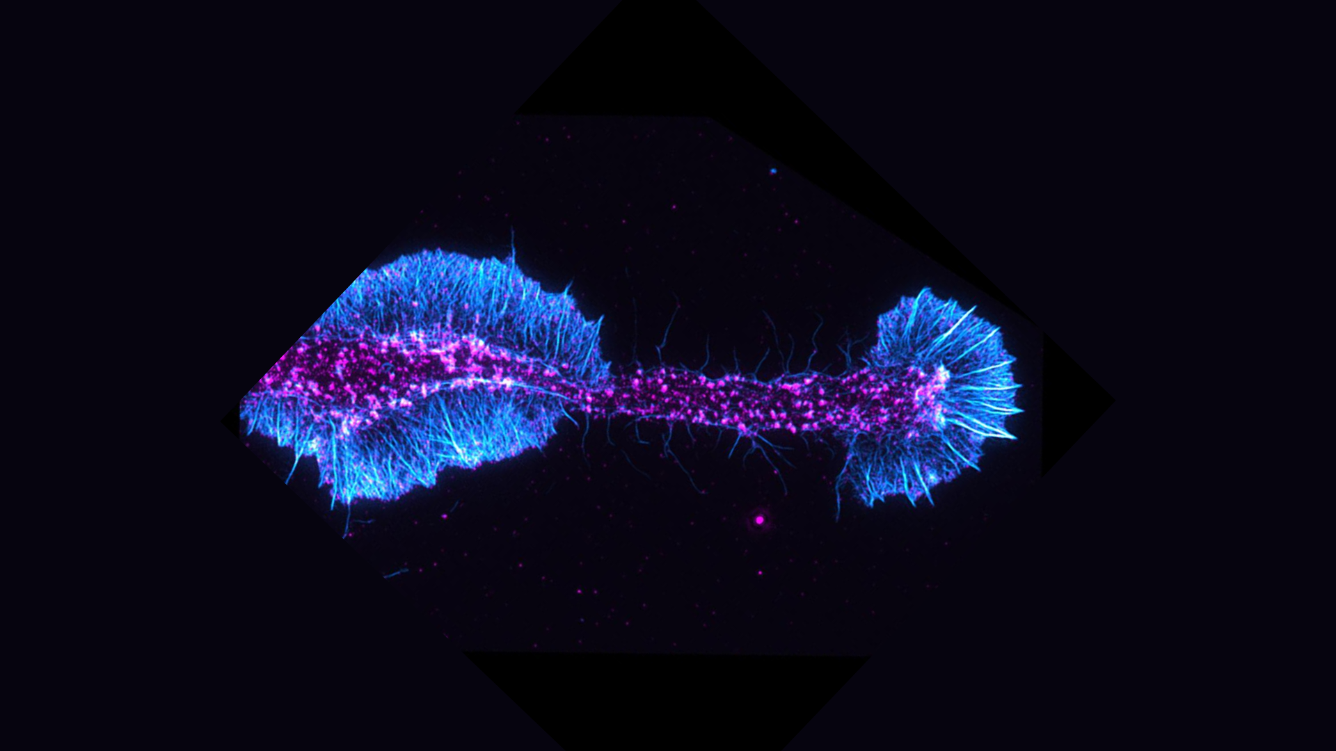 Image of actin filaments (cyan) and an actin regulatory protein (magenta) in a differentiating oligodendrocyte.