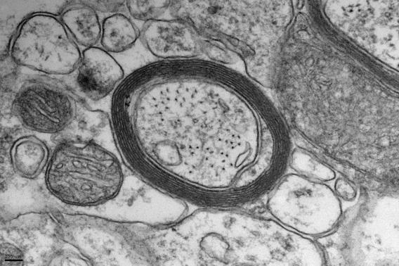 A dark ring of myelin in a black and white image of a cell.
