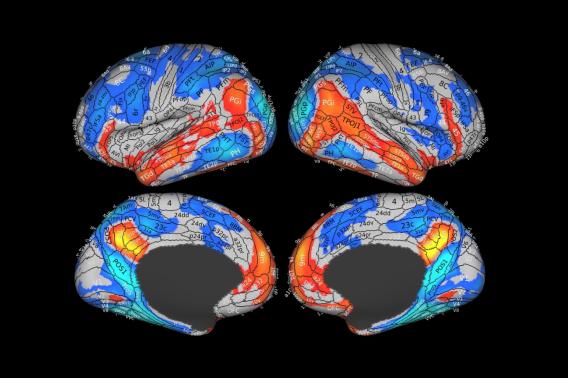 Brain scan images with some regions highlighted in reds and blues.