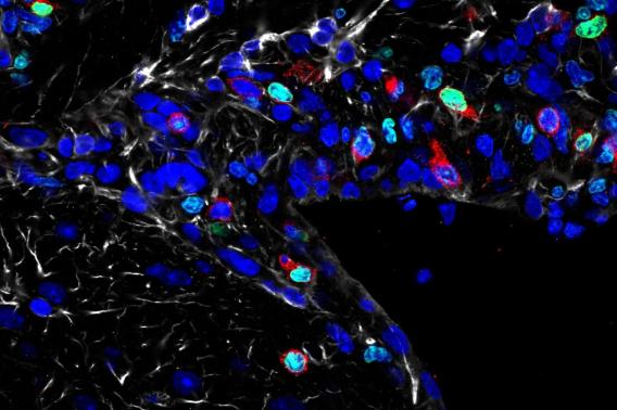 Blue, green, and red blobs on a black background.