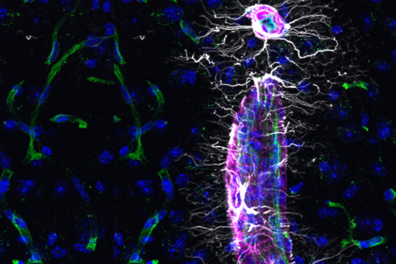 young perivascular flow